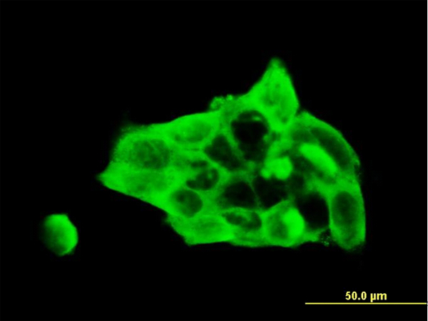 Immunofluorescence of monoclonal antibody to DSC3 on A-431 cell. [antibody concentration 10 ug/ml]