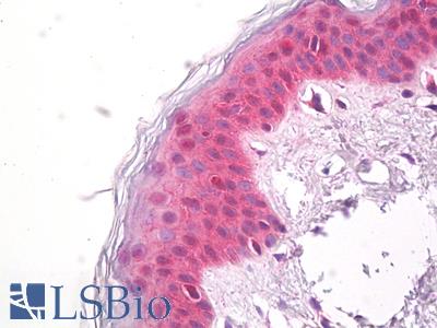 Anti-DSC3 antibody IHC of human skin. Immunohistochemistry of formalin-fixed, paraffin-embedded tissue after heat-induced antigen retrieval. Antibody LS-B7920 dilution 1:50.
