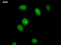 Immunostaining analysis in HeLa cells. HeLa cells were fixed with 4% paraformaldehyde and permeabilized with 0.1% Triton X-100 in PBS. The cells were immunostained with anti-NGRN mAb.