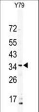 Western blot of DSCR3 Antibody in Y79 cell line lysates (35 ug/lane). DSCR3 (arrow) was detected using the purified antibody.