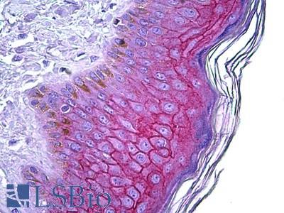 Anti-DSG1 antibody IHC of human skin. Immunohistochemistry of formalin-fixed, paraffin-embedded tissue after heat-induced antigen retrieval. Antibody LS-B5916 concentration 3.75 ug/ml.