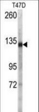 Western blot of anti-DSG2 Antibody (N-term T160) in T47D cell line lysates (35 ug/lane). DSG2 (arrow) was detected using the purified antibody.