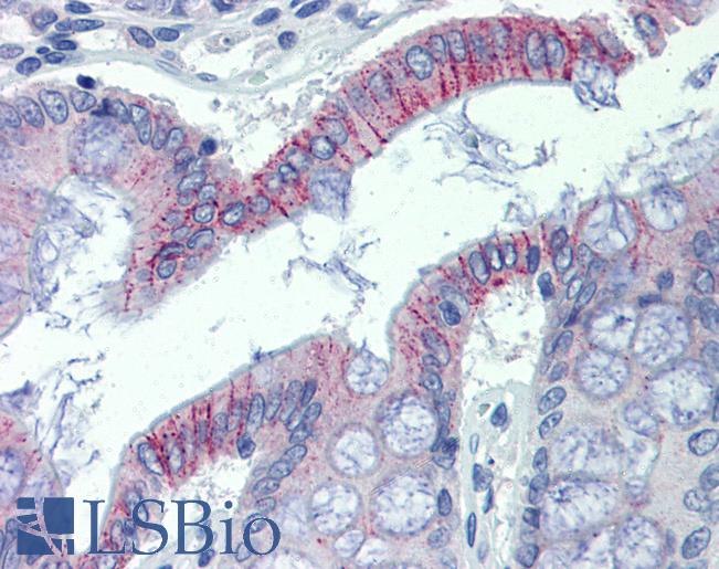 Anti-DSG2 antibody IHC of human colon. Immunohistochemistry of formalin-fixed, paraffin-embedded tissue after heat-induced antigen retrieval. Antibody LS-B3991 concentration 5 ug/ml.