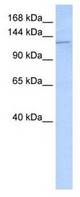 Western analysis of Hela cell lysate.