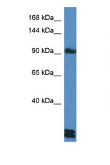 DSG3 antibody LS-C135953 Western blot of HepG2 Cell lysate. Antibody concentration 1 ug/ml.