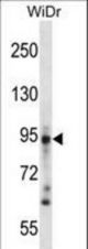 DSG3 Antibody western blot of WiDr cell line lysates (35 ug/lane). The DSG3 antibody detected the DSG3 protein (arrow).