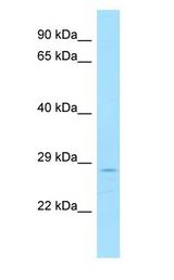 DSN1 antibody Western Blot of MCF7.