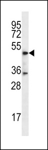 DSN1 Antibody western blot of MDA-MB231 cell line lysates (35 ug/lane). The DSN1 antibody detected the DSN1 protein (arrow).