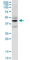 EPYC monoclonal antibody (M06), clone 2G6. Western Blot analysis of EPYC expression in MCF-7.