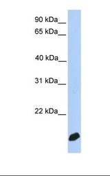 MCF7 cell lysate. Antibody concentration: 1.0 ug/ml. Gel concentration: 12%.
