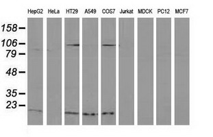 Western blot of extracts (35ug) from 9 different cell lines by using anti-DSTN monoclonal antibody (HepG2: human; HeLa: human; SVT2: mouse; A549: human; COS7: monkey; Jurkat: human; MDCK: canine; PC12: rat; MCF7: human).