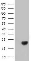 HEK293T cells were transfected with the pCMV6-ENTRY control (Left lane) or pCMV6-ENTRY DSTN (Right lane) cDNA for 48 hrs and lysed. Equivalent amounts of cell lysates (5 ug per lane) were separated by SDS-PAGE and immunoblotted with anti-DSTN.