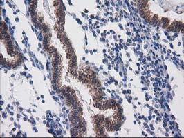 IHC of paraffin-embedded Human endometrium tissue using anti-DSTN mouse monoclonal antibody. (Heat-induced epitope retrieval by 10mM citric buffer, pH6.0, 100C for 10min).