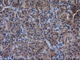 IHC of paraffin-embedded Human pancreas tissue using anti-DSTN mouse monoclonal antibody. (Heat-induced epitope retrieval by 10mM citric buffer, pH6.0, 100C for 10min).
