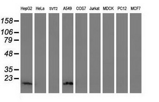 Western blot of extracts (35ug) from 9 different cell lines by using anti-DSTN monoclonal antibody.