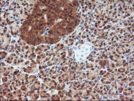 IHC of paraffin-embedded Human pancreas tissue using anti-DSTN mouse monoclonal antibody.