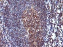 IHC of paraffin-embedded Human tonsil using anti-DSTN mouse monoclonal antibody.