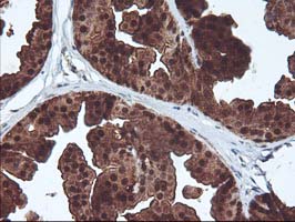 IHC of paraffin-embedded Human breast tissue using anti-DSTN mouse monoclonal antibody.