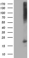 HEK293T cells were transfected with the pCMV6-ENTRY control (Left lane) or pCMV6-ENTRY DSTN (Right lane) cDNA for 48 hrs and lysed. Equivalent amounts of cell lysates (5 ug per lane) were separated by SDS-PAGE and immunoblotted with anti-DSTN.