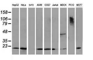 Western blot of extracts (35 ug) from 9 different cell lines by using anti-DSTN monoclonal antibody.