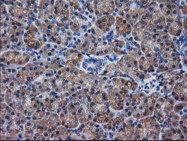 IHC of paraffin-embedded Human pancreas tissue using anti-DSTN mouse monoclonal antibody. (Heat-induced epitope retrieval by 10mM citric buffer, pH6.0, 100C for 10min).