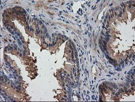 IHC of paraffin-embedded Human prostate tissue using anti-DSTN mouse monoclonal antibody. (Heat-induced epitope retrieval by 10mM citric buffer, pH6.0, 100C for 10min).