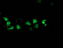 Anti-DSTN mouse monoclonal antibody immunofluorescent staining of COS7 cells transiently transfected by pCMV6-ENTRY DSTN.