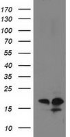 HEK293T cells were transfected with the pCMV6-ENTRY control (Left lane) or pCMV6-ENTRY DSTN (Right lane) cDNA for 48 hrs and lysed. Equivalent amounts of cell lysates (5 ug per lane) were separated by SDS-PAGE and immunoblotted with anti-DSTN.