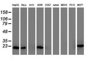 Western blot of extracts (35ug) from 9 different cell lines by using anti-DSTN monoclonal antibody.