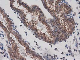 IHC of paraffin-embedded Human endometrium tissue using anti-DSTN mouse monoclonal antibody. (Heat-induced epitope retrieval by 10mM citric buffer, pH6.0, 100C for 10min).