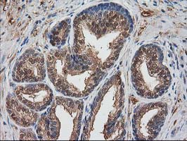 IHC of paraffin-embedded Human prostate tissue using anti-DSTN mouse monoclonal antibody. (Heat-induced epitope retrieval by 10mM citric buffer, pH6.0, 100C for 10min).