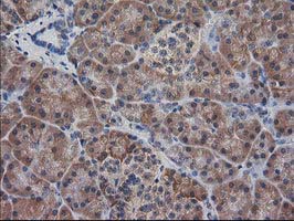 IHC of paraffin-embedded Human pancreas tissue using anti-DSTN mouse monoclonal antibody. (Heat-induced epitope retrieval by 10mM citric buffer, pH6.0, 100C for 10min).