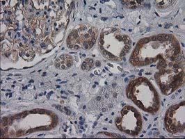 IHC of paraffin-embedded Human Kidney tissue using anti-DSTN mouse monoclonal antibody. (Heat-induced epitope retrieval by 10mM citric buffer, pH6.0, 100C for 10min).