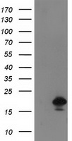 HEK293T cells were transfected with the pCMV6-ENTRY control (Left lane) or pCMV6-ENTRY DSTN (Right lane) cDNA for 48 hrs and lysed. Equivalent amounts of cell lysates (5 ug per lane) were separated by SDS-PAGE and immunoblotted with anti-DSTN.