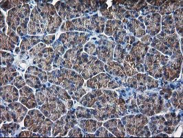 IHC of paraffin-embedded Human pancreas tissue using anti-DSTN mouse monoclonal antibody. (Heat-induced epitope retrieval by 10mM citric buffer, pH6.0, 100C for 10min).