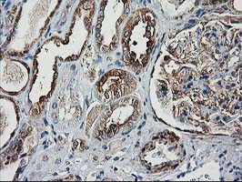 IHC of paraffin-embedded Human Kidney tissue using anti-DSTN mouse monoclonal antibody. (Heat-induced epitope retrieval by 10mM citric buffer, pH6.0, 100C for 10min).