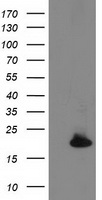 HEK293T cells were transfected with the pCMV6-ENTRY control (Left lane) or pCMV6-ENTRY DSTN (Right lane) cDNA for 48 hrs and lysed. Equivalent amounts of cell lysates (5 ug per lane) were separated by SDS-PAGE and immunoblotted with anti-DSTN.