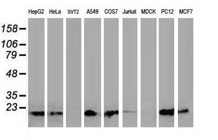 Western blot of extracts (35ug) from 9 different cell lines by using anti-DSTN monoclonal antibody.
