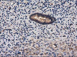 IHC of paraffin-embedded Human endometrium tissue using anti-DSTN mouse monoclonal antibody.