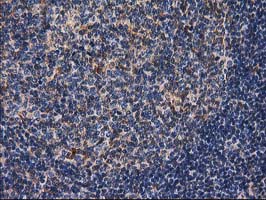 IHC of paraffin-embedded Human lymph node tissue using anti-DSTN mouse monoclonal antibody.