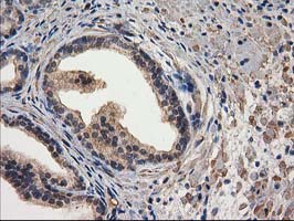 IHC of paraffin-embedded Human prostate tissue using anti-DSTN mouse monoclonal antibody.