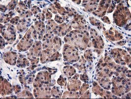IHC of paraffin-embedded Human pancreas tissue using anti-DSTN mouse monoclonal antibody.