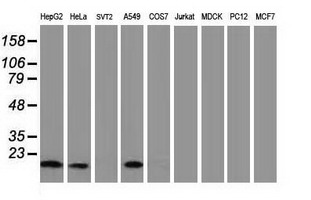 Western blot of extracts (35 ug) from 9 different cell lines by using anti-DSTN monoclonal antibody.