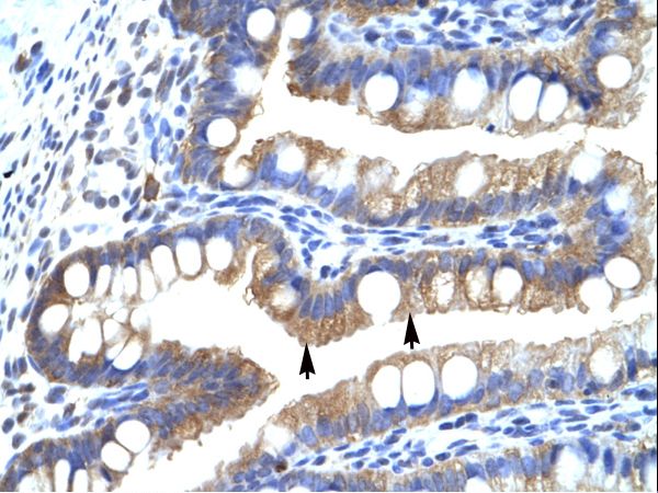 CLIC5 antibody LS-C30979 was used in IHC to stain formalin-fixed, paraffin-embedded human intestine.