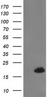 HEK293T cells were transfected with the pCMV6-ENTRY control (Left lane) or pCMV6-ENTRY DSTN (Right lane) cDNA for 48 hrs and lysed. Equivalent amounts of cell lysates (5 ug per lane) were separated by SDS-PAGE and immunoblotted with anti-DSTN.