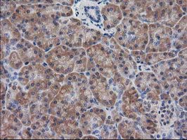 IHC of paraffin-embedded Human pancreas tissue using anti-DSTN mouse monoclonal antibody.