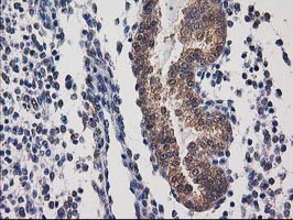 IHC of paraffin-embedded Human endometrium tissue using anti-DSTN mouse monoclonal antibody.