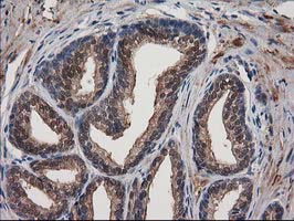 IHC of paraffin-embedded Human prostate tissue using anti-DSTN mouse monoclonal antibody.