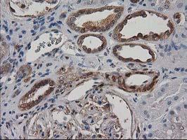 IHC of paraffin-embedded Human Kidney tissue using anti-DSTN mouse monoclonal antibody.