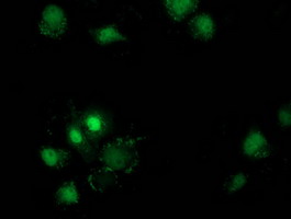 Anti-DSTN mouse monoclonal antibody immunofluorescent staining of COS7 cells transiently transfected by pCMV6-ENTRY DSTN.
